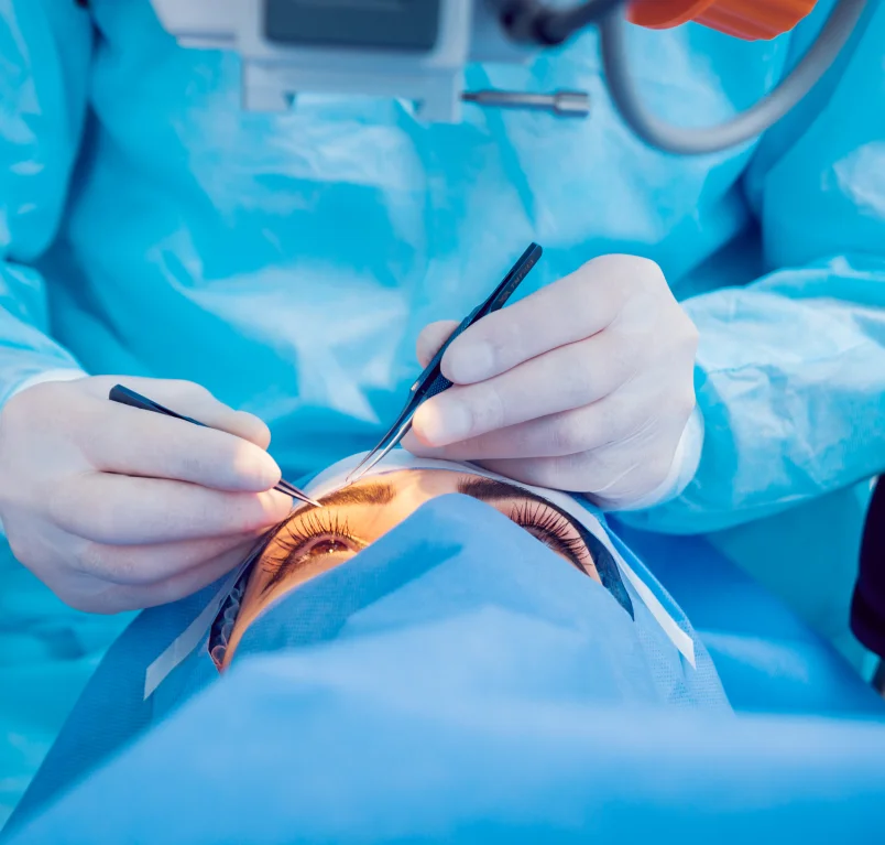 ocular plasty surgery